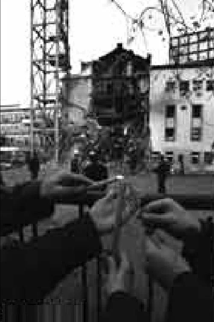 02:06 - Anatomija bola