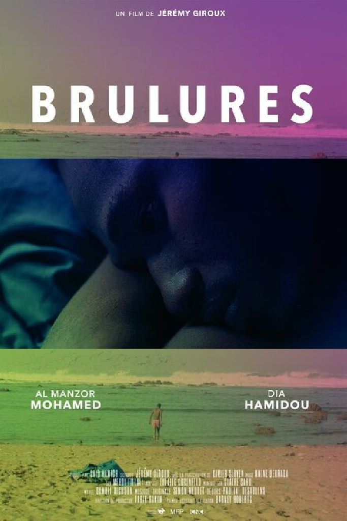 Brûlures