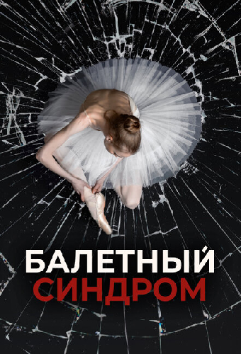 Балетный синдром