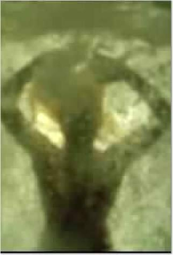 Choices