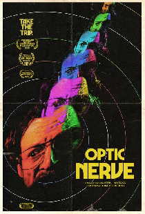 Optic Nerve