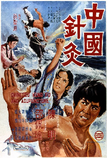 中國針灸