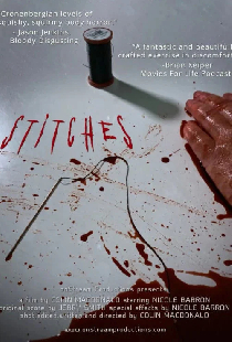 Stitches