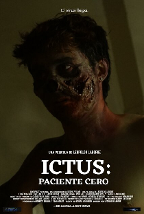 Ictus: Paciente Cero