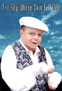 Мальчик, который остался без кожи