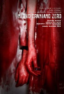 Nervo Craniano Zero